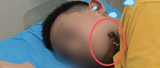 危险！12岁男孩湖边玩耍，被它一口“咬”脸……-八博网